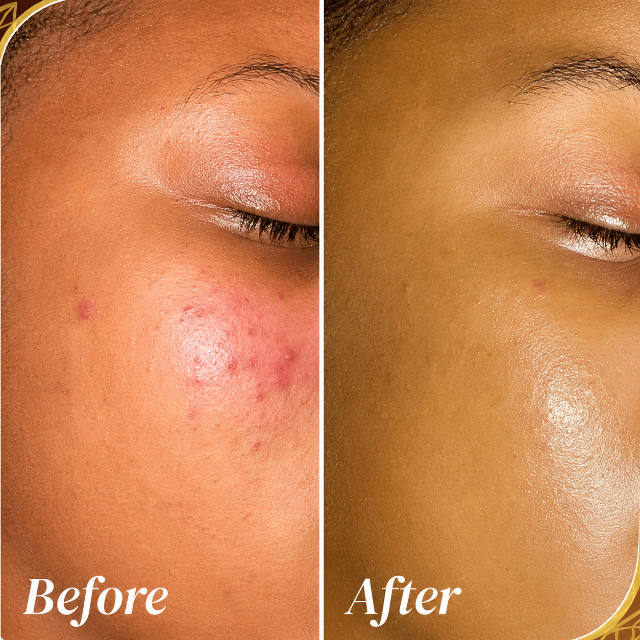 Hyperpigmentation & Skin Tone Correction